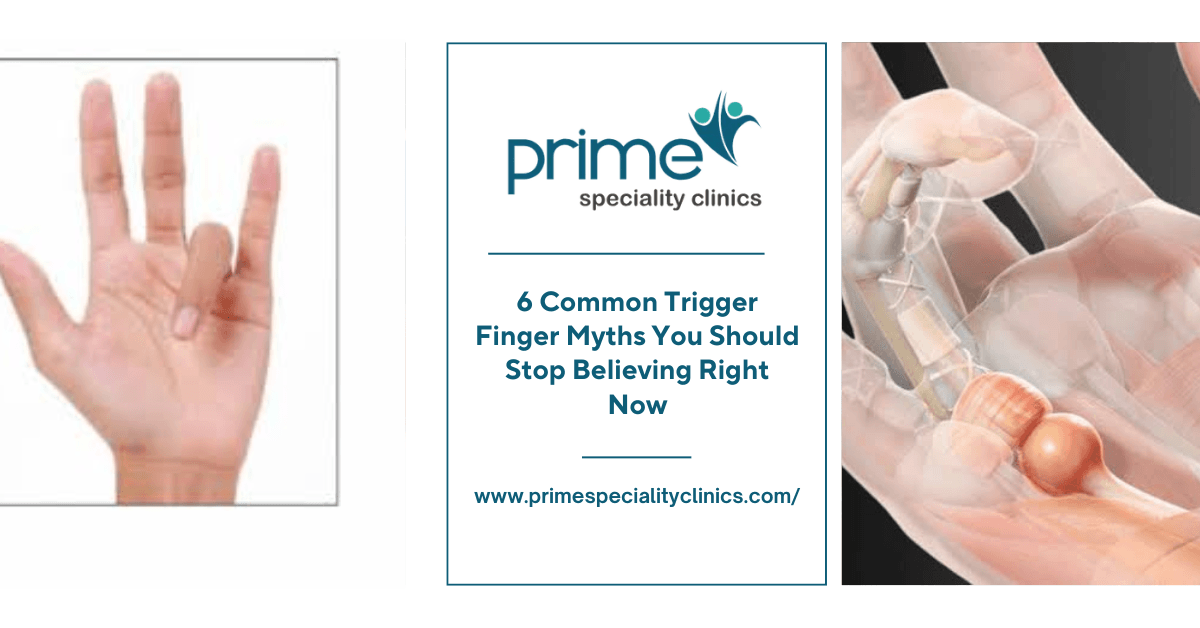 6 Common Trigger Finger Myths You Should Stop Believing Right Now