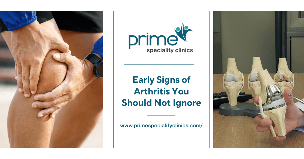 Early Signs of Arthritis You Should Not Ignore