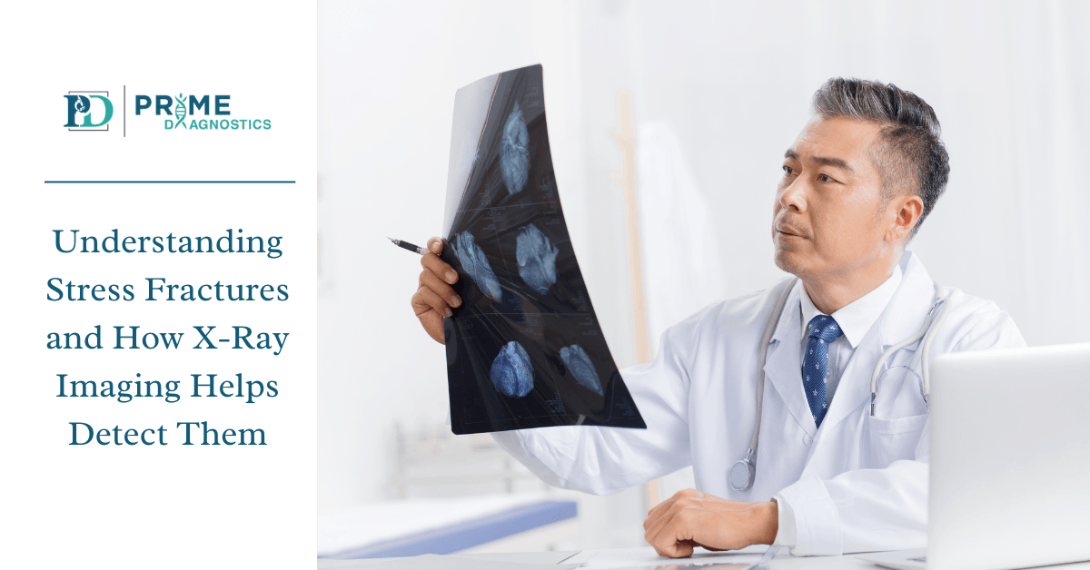 Understanding Stress Fractures and How X-Ray Imaging Helps Detect Them