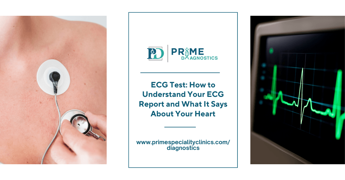 ECG Test: How to Understand Your ECG Report and What It Says About Your Heart